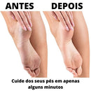 Removedor de calos-CleanFeet
